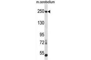 Western blot analysis in mouse cerebellum tissue lysates (35ug/lane) using CD171 / L1CAM Antibody . (L1CAM Antikörper  (C-Term))