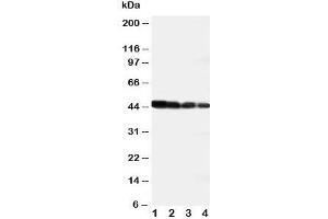 Western blot testing of DLL3 antibody and recombinant human protein;  Lane 1: 10ng;  2: 5ng;  3: 2. (DLL3 Antikörper  (AA 599-618))