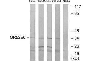 Western blot analysis of extracts from HeLa cells, HepG2 cells, COLO cells and MCF-7 cells, using OR52E6 antibody. (OR52E6 Antikörper  (C-Term))
