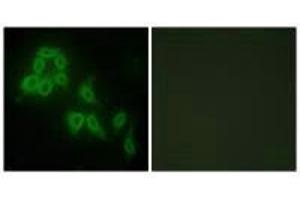 Immunofluorescence analysis of HepG2 cells, using Collagen V α2 antibody.