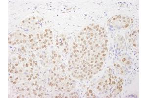Immunohistochemistry (IHC) image for anti-RNA polymerase-associated protein RTF1 homolog (RTF1) (C-Term) antibody (ABIN7449019)