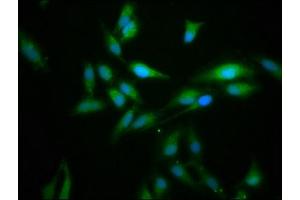 Immunofluorescence staining of Hela cells with ABIN7165598 at 1:166, counter-stained with DAPI. (FLII Antikörper  (AA 577-729))