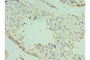 Immunohistochemistry of paraffin-embedded human testis tissue using ABIN7170477 at dilution of 1:100