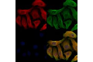 ABIN6263787 and ABIN6278498 staining Hela cells by IF/ICC. (SLC22A6 Antikörper  (Internal Region))