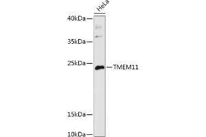 Western blot analysis of extracts of HeLa cells, using TMEM11 antibody (ABIN7270952) at 1:1000 dilution. (TMEM11 Antikörper  (AA 1-80))