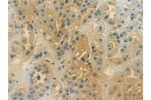anti-BCL2-Like 10 (Apoptosis Facilitator) (BCL2L10) (Internal Region) antibody