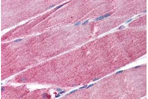 Human Skeletal Muscle (formalin-fixed, paraffin-embedded) stained with TRIM63 antibody ABIN297307 at 1. (TRIM63 Antikörper  (AA 247-261))