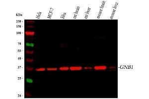 Western blot analysis of GNB1 using anti-GNB1 antibody (ABIN4886607).