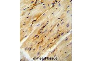 GPD1L antibody (N-term) immunohistochemistry analysis in formalin fixed and paraffin embedded mouse heart tissue followed by peroxidase conjugation of the secondary antibody and DAB staining.