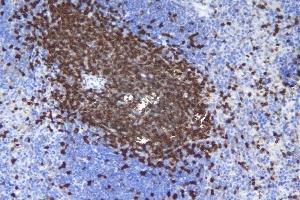IHC analysis of CD5 using anti-CD5 antibody (ABIN7600839). (CD5 Antikörper  (AA 24-494))