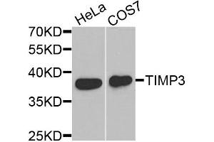 Western blot analysis of extracts of HeLa and COS7 cells, using TIMP3 antibody. (TIMP3 Antikörper)