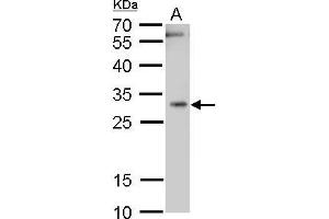 WB Image Heme Oxygenase 1 antibody detects Heme Oxygenase 1 protein by western blot analysis. (HMOX1 Antikörper)