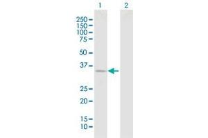 Western Blotting (WB) image for anti-Defective in Cullin Neddylation 1, Domain Containing 1 (DCUN1D1) (AA 1-259) antibody (ABIN527032)