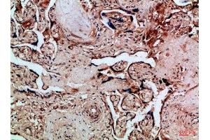 Immunohistochemical analysis of paraffin-embedded Human-placenta, antibody was diluted at 1:100 (FLT4 Antikörper  (AA 720-760))
