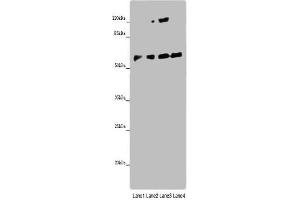 Western blot All lanes: ANGPTL2 antibody at 8 μg/mL Lane 1: Mouse spleen tissue Lane 2: K562 whole cell lysate Lane 3: Hela whole cell lysate Lane 4: A549 whole cell lysate Secondary Goat polyclonal to rabbit IgG at 1/10000 dilution Predicted band size: 58, 23 kDa Observed band size: 58 kDa (ANGPTL2 Antikörper  (AA 23-493))
