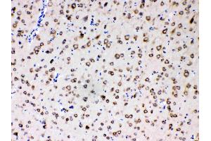 Immunohistochemistry (IHC) image for anti-Ribosomal Protein S27 (RPS27) (AA 2-84) antibody (ABIN4886714)