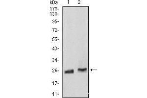 Western Blotting (WB) image for anti-RAB5A, Member RAS Oncogene Family (RAB5A) (AA 1-215) antibody (ABIN5876083) (RAB5 Antikörper  (AA 1-215))