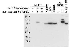Western blot using  Protein A purified anti-SPS2 antibody shows detection of SPS2 in NIH3T3 cells over-expressing this protein. (SEPHS2 Antikörper)