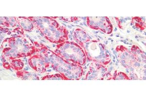 Immunohistochemistry (IHC) image for anti-Myosin Heavy Chain 11, Smooth Muscle (MYH11) (AA 162-315) antibody (ABIN7441043)