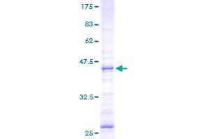 Neuromedin U Protein (NMU) (AA 36-174) (GST tag)