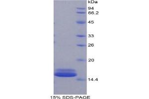 SDS-PAGE analysis of Mouse FABP4 Protein. (FABP4 Protein)