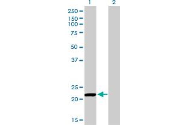 Peroxiredoxin 2 Antikörper  (AA 1-198)