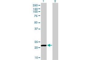 Western Blot analysis of PRDX2 expression in transfected 293T cell line by PRDX2 monoclonal antibody (M01), clone 4E10-2D2. (Peroxiredoxin 2 Antikörper  (AA 1-198))