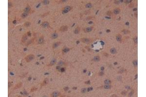 Detection of APC in Mouse Brain Tissue using Polyclonal Antibody to Adenomatosis Polyposis Coli Protein (APC) (APC Antikörper  (AA 2636-2845))