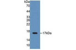 Figure. (Uroplakin 2 Antikörper  (AA 26-153))