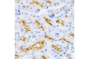 Immunohistochemical analysis of MBP staining in rat kidney formalin fixed paraffin embedded tissue section. (MBP Antikörper)