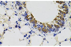Immunohistochemistry of paraffin-embedded Mouse lung using CD59 Polyclonal Antibody (CD59 Antikörper)