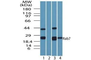 Rab-7 Western Blot. (RAB7A Antikörper)