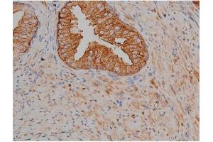ABIN6267356 at 1/200 staining Human prostate tissue sections by IHC-P.