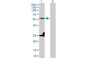 Western Blot analysis of KRT8 expression in transfected 293T cell line by KRT8 MaxPab polyclonal antibody. (KRT8 Antikörper  (AA 1-483))