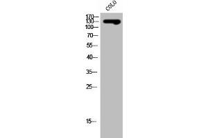 Western Blot analysis of COLO cells using SLC4A8/10 Polyclonal Antibody (SLC4A8/SLC4A1 (Internal Region) Antikörper)