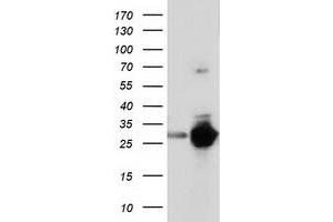 Western Blotting (WB) image for anti-Sepiapterin Reductase (SPR) antibody (ABIN1501113) (SPR Antikörper)