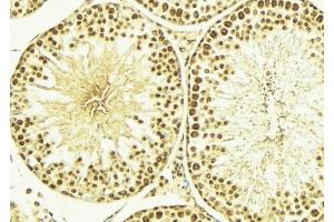 ABIN6266652 at 1/100 staining Mouse testis tissue by IHC-P.