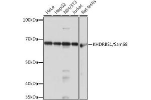 Western blot analysis of extracts of various cell lines, using KHDRBS1/KHDRBS1/Sam68 Rabbit mAb (ABIN1680037, ABIN3018237, ABIN3018238 and ABIN7101585) at 1:1000 dilution. (KHDRBS1 Antikörper)