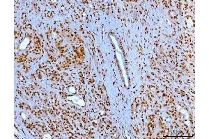 IHC analysis of YY1 using anti-YY1 antibody (ABIN7603000).
