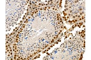 Phospho-SMC1 (Ser966) Antibody at 1/100 staining Mouse testis tissue by IHC-P. (SMC1A Antikörper  (pSer966))