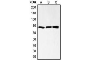 Western blot analysis of CD200R expression in HL60 (A), CCRFCEM (B), AML193 (C) whole cell lysates.