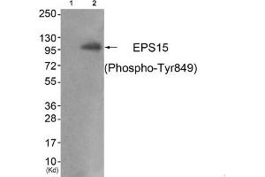 Western blot analysis of extracts from JK cells (Lane 2), using EPS15 (Phospho-Tyr849) Antibody. (EPS15 Antikörper  (pTyr849))