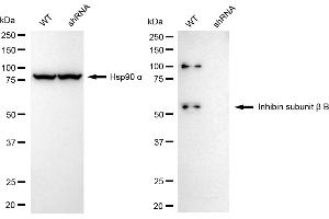 Western blotting analysis using inhibin subunit beta B antibody (ABIN7800941). (Rekombinanter Inhibin Subunit beta B Antikörper)