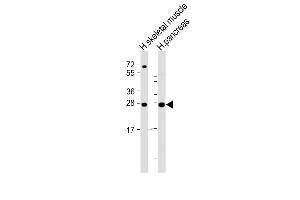 All lanes : Anti-CELA2B Antibody (Center) at 1:2000 dilution Lane 1: human skeletal muscle lysate Lane 2: human pancreas lysate Lysates/proteins at 20 μg per lane. (ELA2B Antikörper  (AA 88-122))