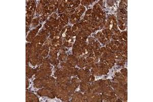 Immunohistochemical staining of human stomach with PIGN polyclonal antibody  shows strong cytoplasmic positivity in glandular cells at 1:200-1:500 dilution. (PIGN Antikörper)