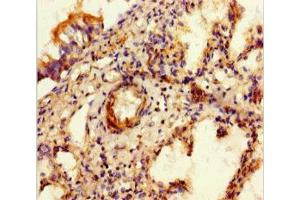 Immunohistochemistry of paraffin-embedded human lung tissue using ABIN7152342 at dilution of 1:100 (SULF1 Antikörper  (AA 105-372))