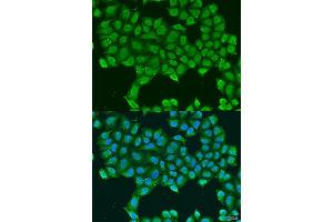 Immunofluorescence analysis of U2OS cells using ATP5O antibody. (ATP5O Antikörper  (AA 24-213))