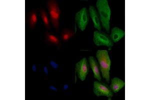 ABIN6264736 and ABIN6279770 staining  cells by IF/ICC. (ARHGAP25 Antikörper  (Internal Region))