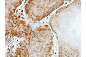 Immunohistochemistry (IHC) image for anti-Eukaryotic Translation Initiation Factor 2, Subunit 2 Beta, 38kDa (EIF2S2) antibody (ABIN2856393)
