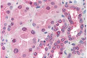 Human Kidney (formalin-fixed, paraffin-embedded) stained with TOM1L1 antibody ABIN297711 at 20 ug/ml followed by biotinylated goat anti-rabbit IgG secondary antibody ABIN481713, alkaline phosphatase-streptavidin and chromogen. (TOM1L1 Antikörper  (C-Term))